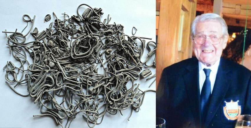 Logam Ranjau Tertanam 68 Tahun di Kaki